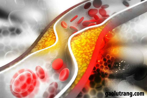 Đậu đen làm giảm cholesterol trong máu